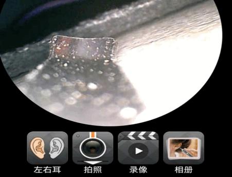 Cuckooyun可视采耳app官方版