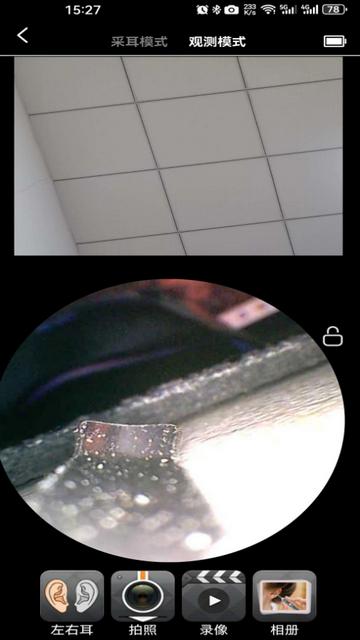 Cuckooyun可视采耳app官方版