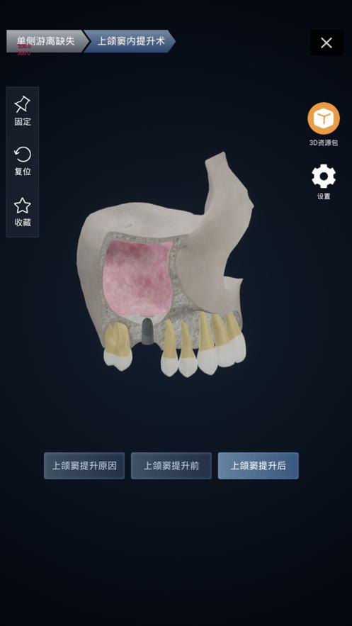 聊牙 版本：v1.8.0