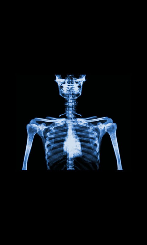 人体透视相机 版本：v3.1.2