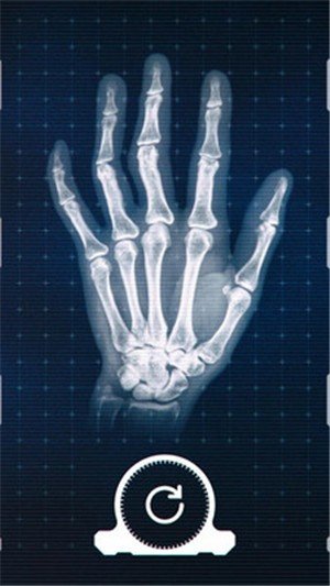 真实X射线模拟器 版本：v1.1