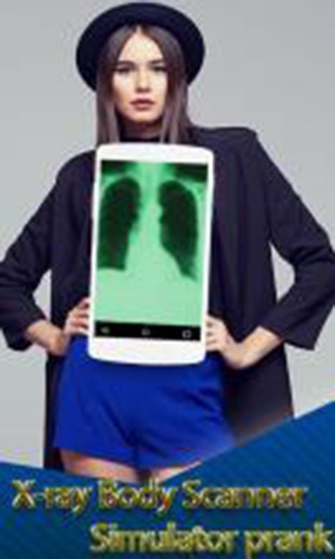 人体透视相机 版本：v3.1.2