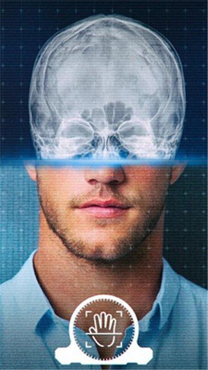 真实X射线模拟器 版本：v1.1