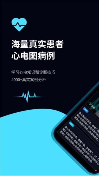 心电图ECG图片