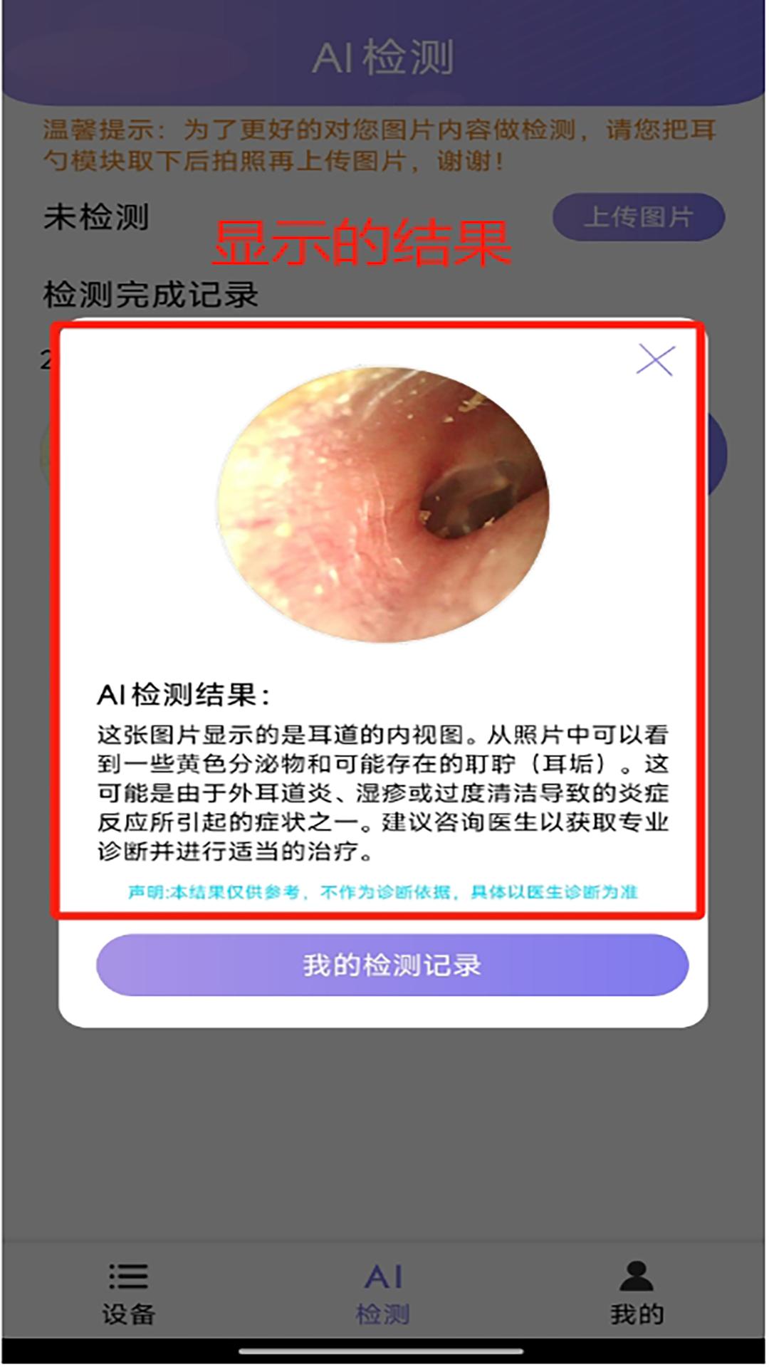 Ai耳勺下载介绍图